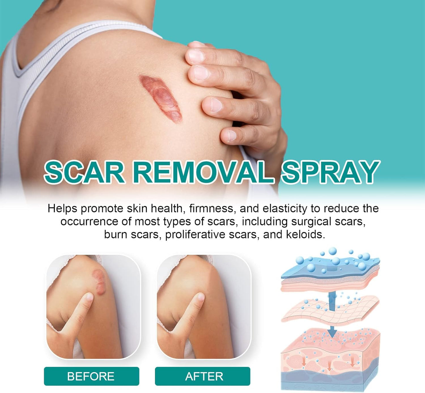 Scar Spray