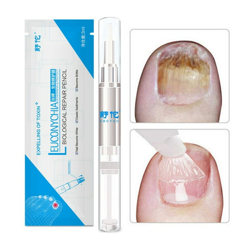 Nail fungal treatment pen
