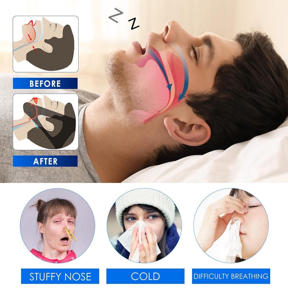 Snore Spray al Ingredients Reduce Snoring Improve Nasal Congestion Relieve Rhinitis