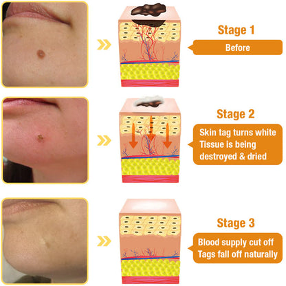 Tag Recede Bees Treatment Spray