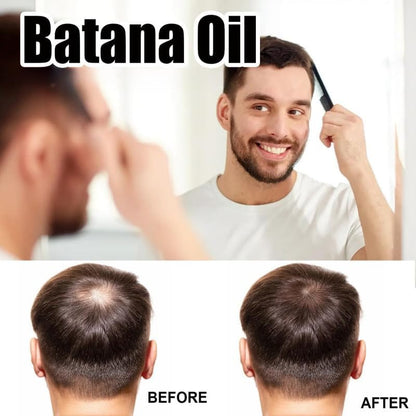 Batana Oil – 100% Natural Hair & Skin Booster