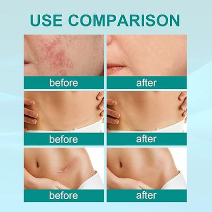 Scar Spray